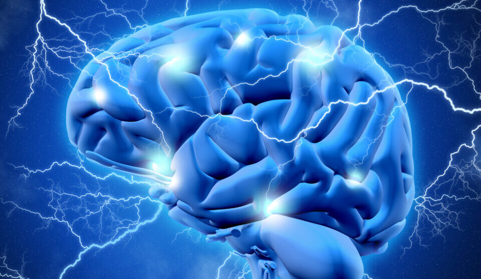 Alzheimer's and dementia brain concept